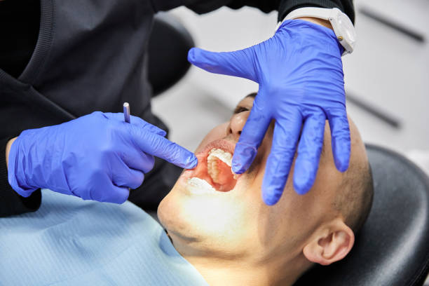 Best Emergency Dental Care for Broken or Chipped Teeth in Smyrna, GA