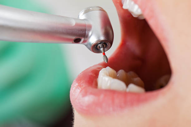 Best Emergency Denture Repair in Smyrna, GA